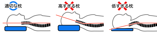 首の痛みで眠れない夜、これで解決！効果的な対処法とは？